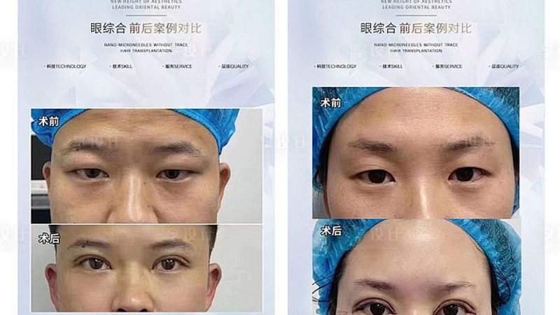医美医院口碑评价怎么看