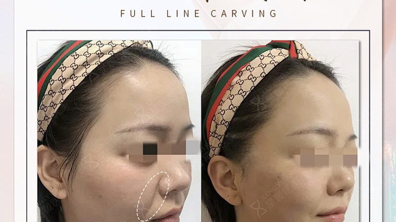 皮肤管理中心拓客话术：如何精准把握客户需求