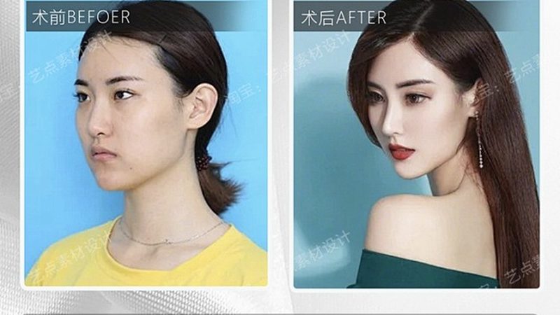 注射美容材料定制OEM：揭秘定制化美容材料的秘密