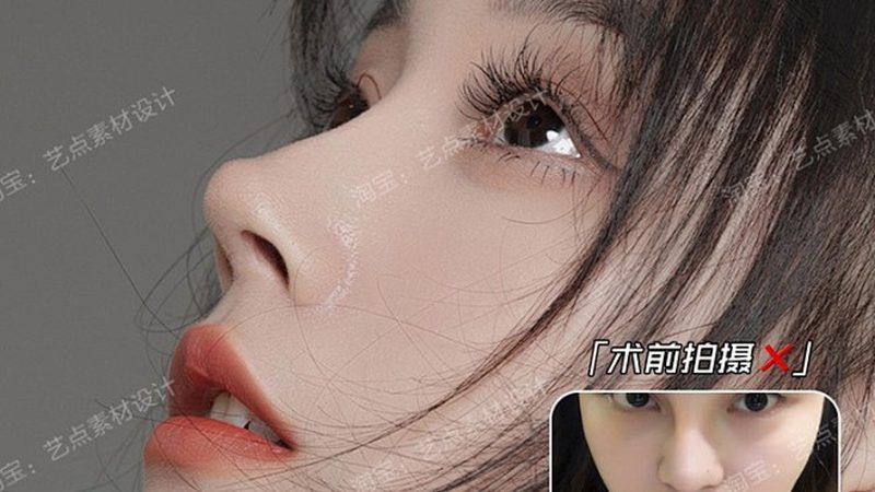 双眼皮整形，术前准备知多少？**