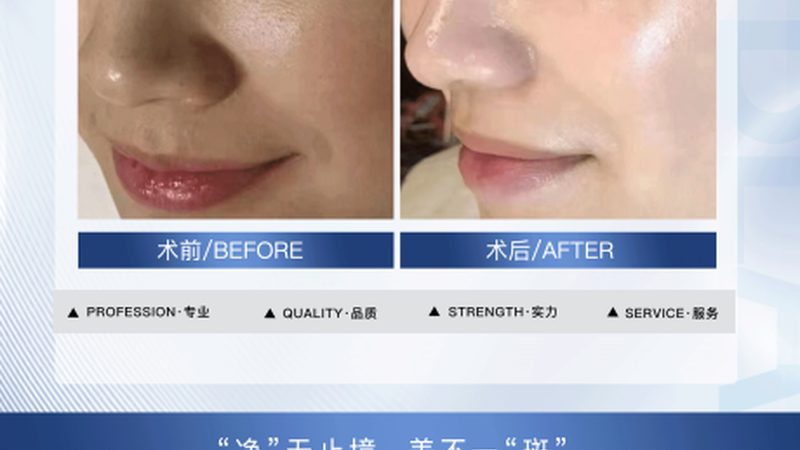 皮肤管理工作室仪器配置方案
