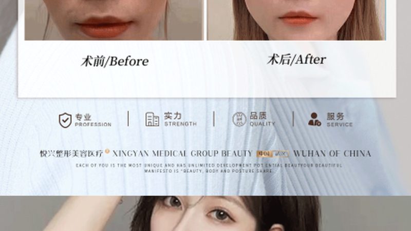 在选择上游厂家时，要规避以下风险：
