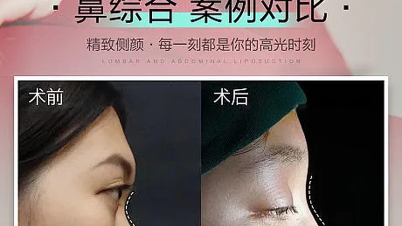 瘦脸面罩后遗症：了解这些，安心变美