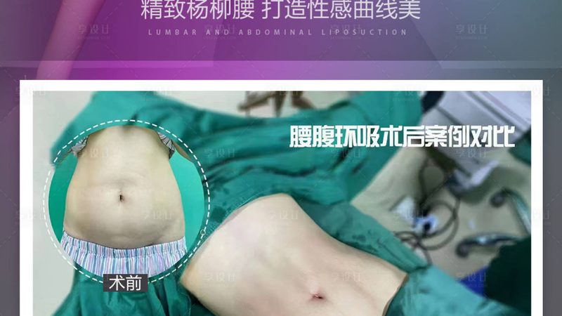 医美手术麻醉，规范操作背后的安全守护