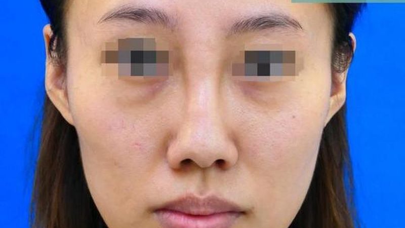 皮肤管理仪器：揭秘参数背后的秘密